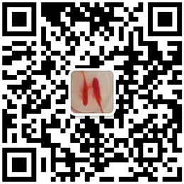 安全滑觸線(xiàn) 安全滑觸線(xiàn)